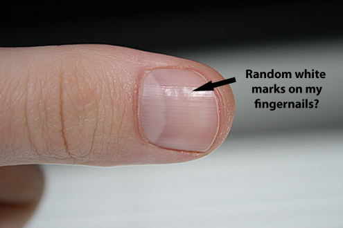 There are many myths surrounding those mysterious white spots on fingernails